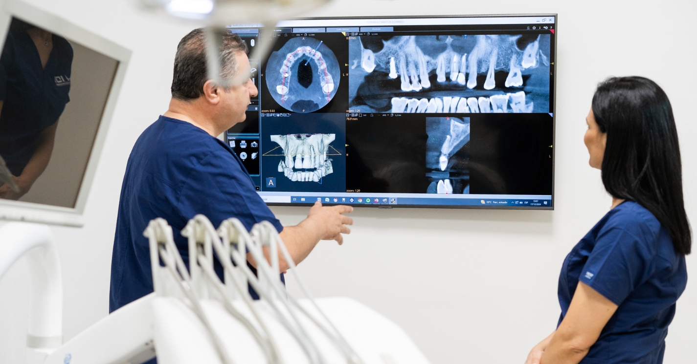 Implantes dentales de carga inmediata: la solución para tener dientes fijos en 1 día
